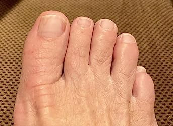 Healthy natural toenails